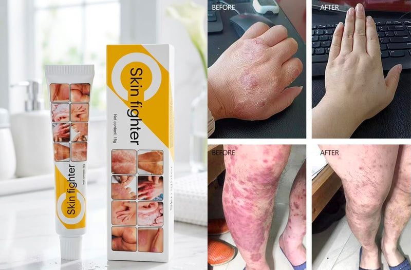 Skin Figher Cream original