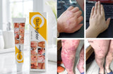 Skin Figher Cream original